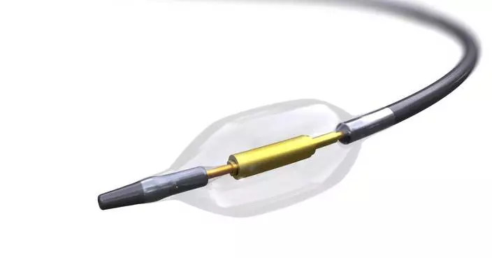 Otsuka Medical Devices/Otsuka Pharmaceutical: Paradise Ultrasound Renal Denervation System for the Treatment of Resistant Hypertension, Now Covered by Insurance and Commercially Available in Japan