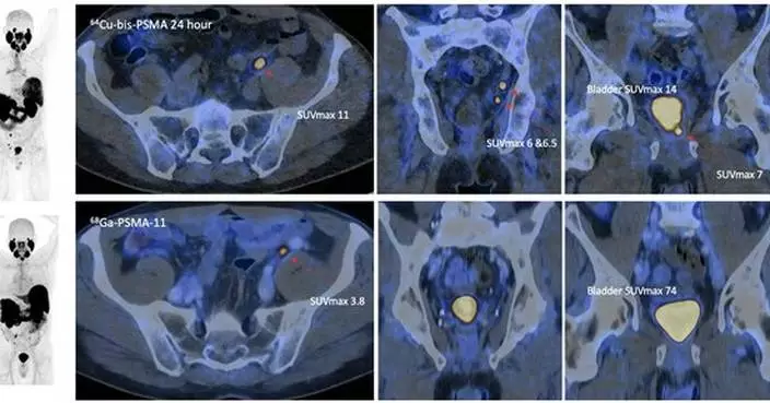 Co-PSMA data presented at EAU Annual Congress 2026 with manuscript accepted for publication in the European Urology journal