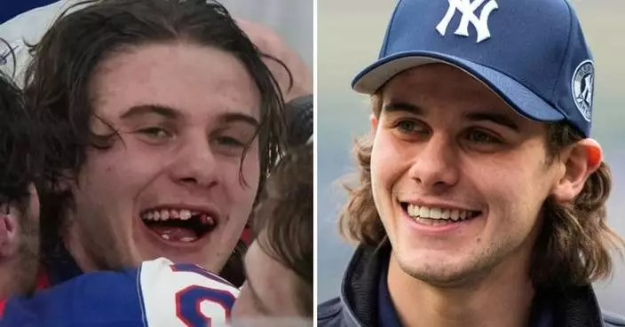 Olympic hero Jack Hughes has new chiclets as NHL dentists get a moment in the spotlight