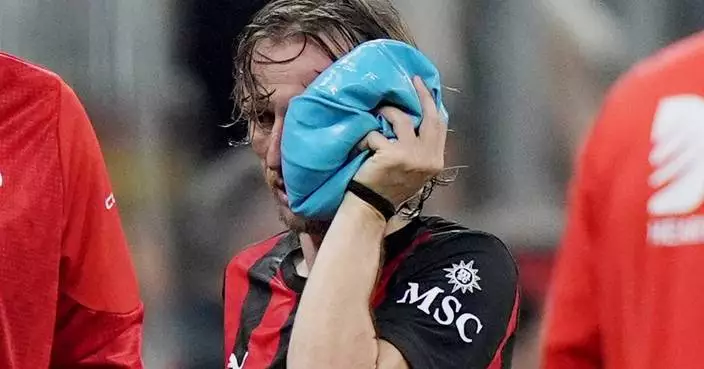 AC Milan and Croatia midfielder Modric breaks cheekbone and in race to be World Cup ready