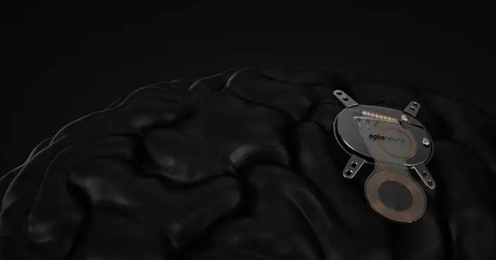 Epia Neuro Launches to Develop Intent-Driven Neural Technology to Restore Function After Stroke and Address Cognitive Decline