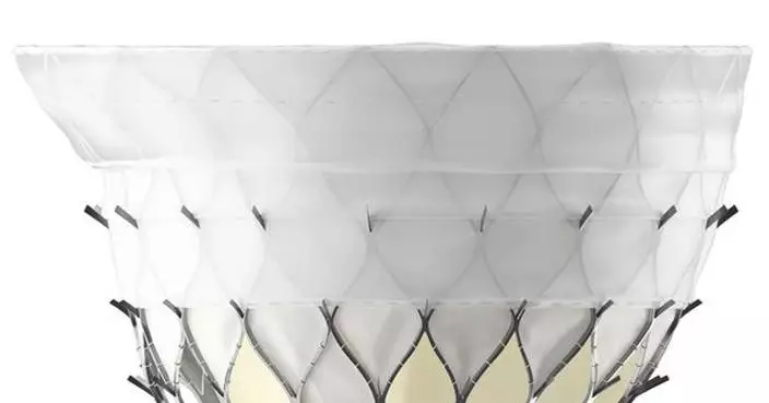 First Implant of KingstronBio's ProStyle M® Transcatheter Mitral Valve System Successfully Completed in National Multicenter Confirmatory Study