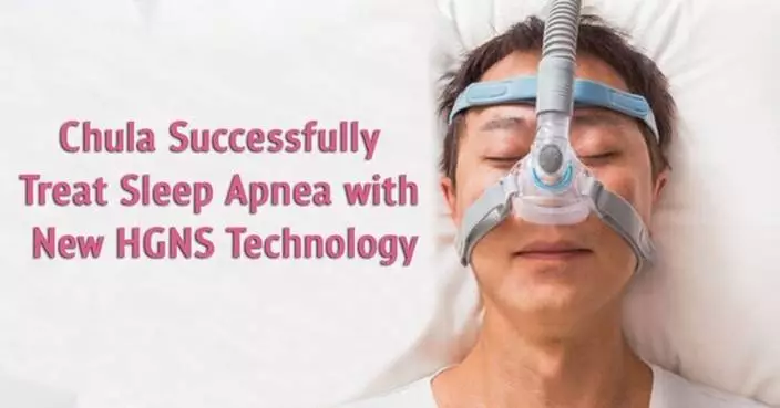 Chulalongkorn University doctors successfully performed surgery for obstructive sleep apnea using the new HGNS technique the fourth successful surgery of this kind in Asia