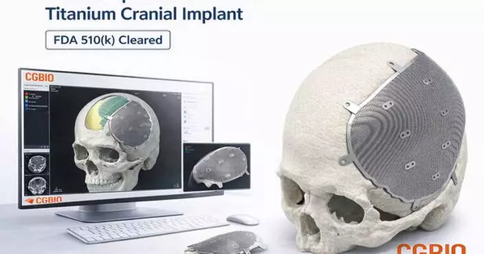 CGBIO Receives FDA 510(k) Clearance for Patient-Specific Titanium Implant 'EASYMADE TI'