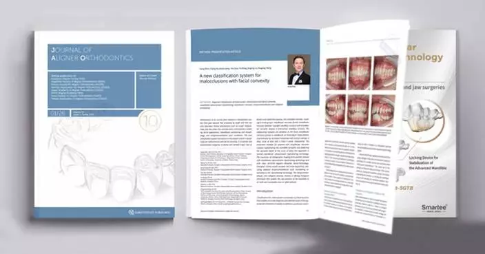 New Classification System of Malocclusions Published in the Journal of Aligner Orthodontics (JAO) by Prof. Gang Shen's Team
