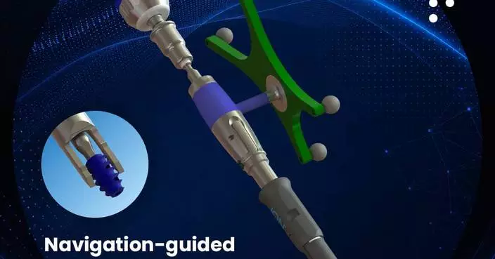 SurGenTec Secures FDA Clearance for ION-C™ – Now Navigation Compatible