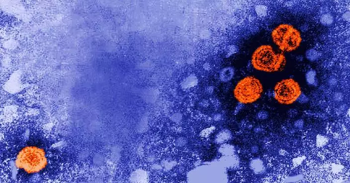 Experimental hepatitis B drug may offer 'functional cure' for some patients