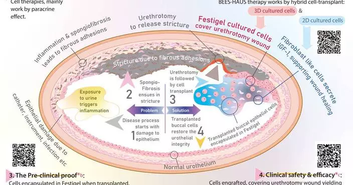 Pioneering feat in regenerative medicine, the BEES-HAUS cell therapy: Paracrine effect and cell engraftment, together healing urethral stricture. Its simplified version, BHES-HAUS’ results to be presented in AUA 2026