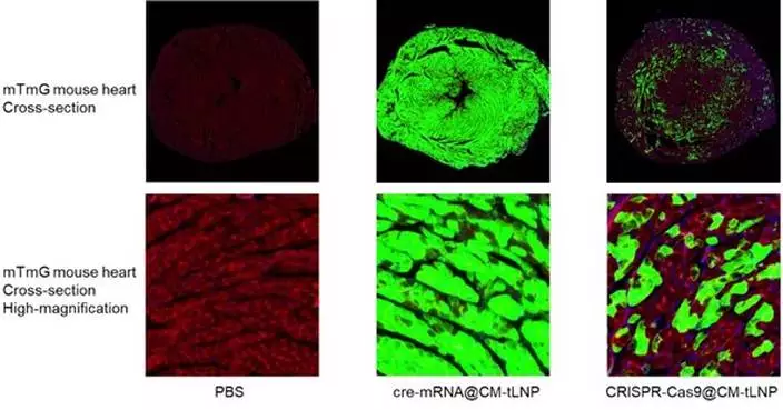 METiS TechBio to Present Late-Breaking Data on Near-Complete Cardiomyocyte Delivery at CRS 2026