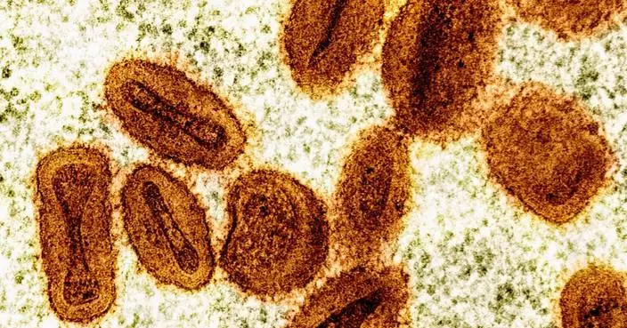 2 scientists charged with bringing deactivated mpox virus into the US and lying to authorities