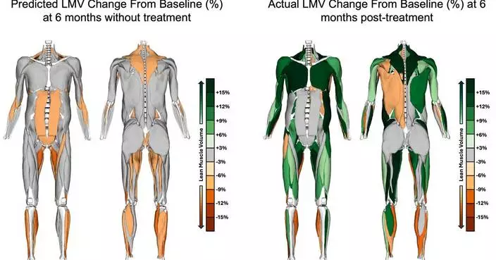 Epicrispr Reports First Clinical Evidence of Increased Lean Muscle Volume in Patients with FSHD Following Treatment with EPI-321