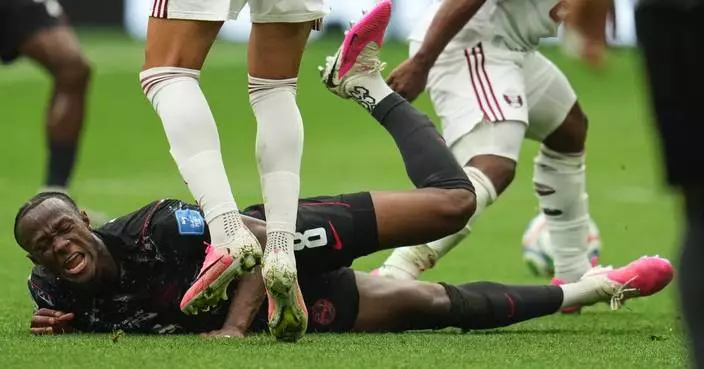 One Extraordinary Photo: Canada's Ismael Kone reacts to his injury