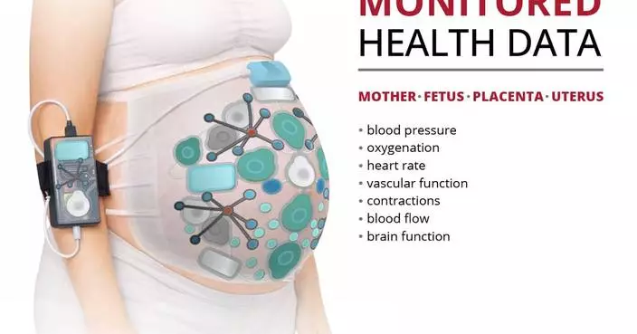 Carnegie Mellon Team Awarded ARPA-H Contract to Transform Care During Labor and Childbirth