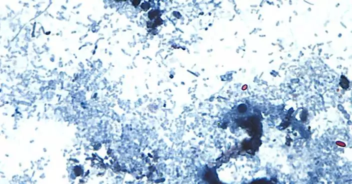 Outbreak of diarrhea-causing parasite grows to more than 1,000 cases