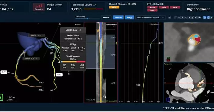 Elucid to Showcase CCTA Vision at SCCT 2026, Defining the Future of Personalized Cardiovascular Care