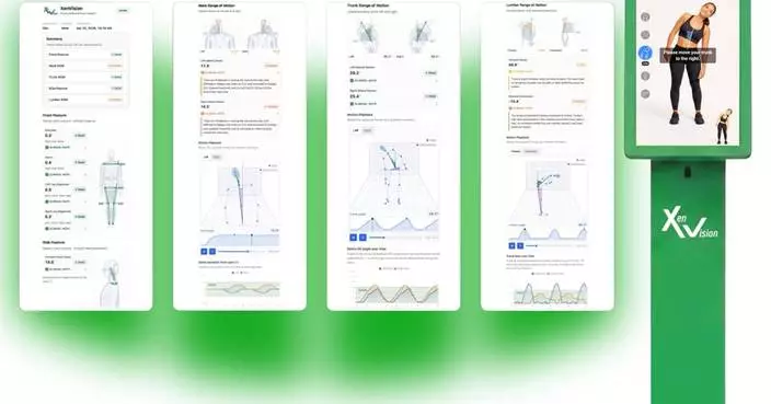 Xenco Medical Unveils XenVision, an AI-Driven Musculoskeletal Health Breakthrough at SIGGRAPH 2026, the World’s Premier Computer Graphics Conference