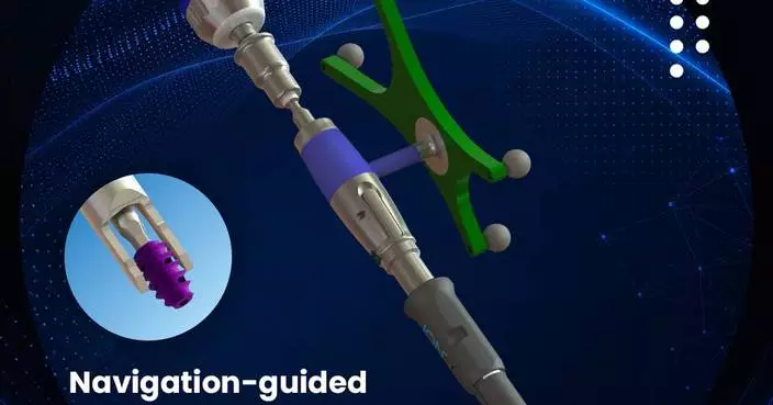 SurGenTec® Secures FDA Clearance for ION-L™ - Lumbar Navigation Compatible