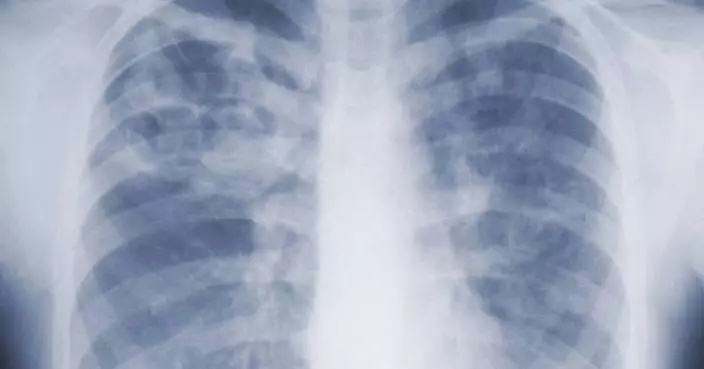 Study suggests the threat of mold-associated illnesses may be underappreciated