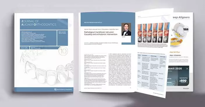 Professor Gang Shen's Orthodontic Team Publishes Third Consecutive Paper in the Journal of Aligner Orthodontics
