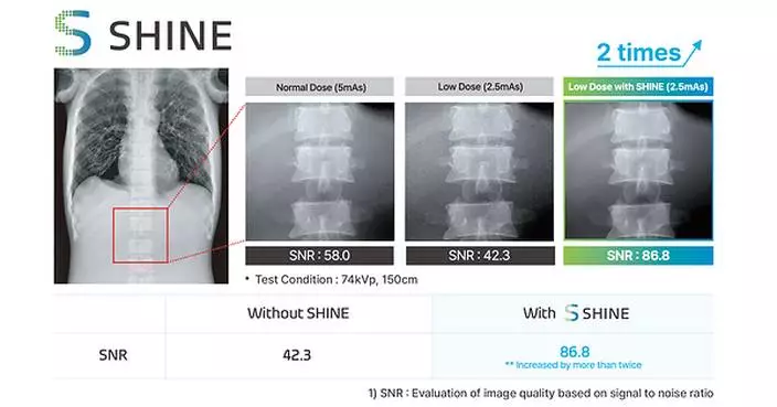 Rayence Launches 'SHINE,' a Next-Generation X-ray Image Processing Technology for Low Dose Imaging