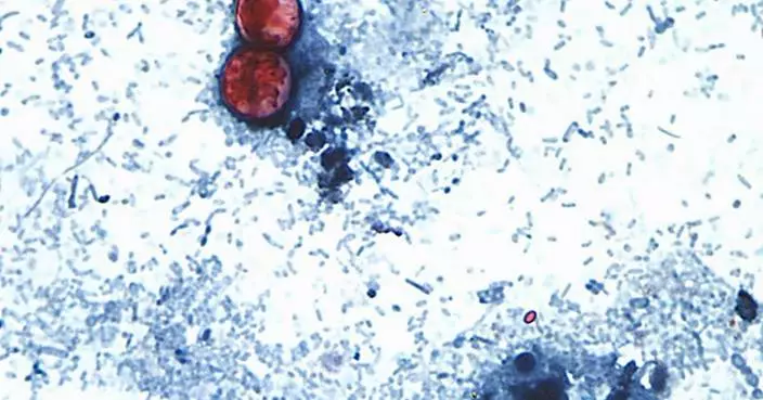 US officials tie cyclospora outbreak involving iceberg lettuce to 3 more states