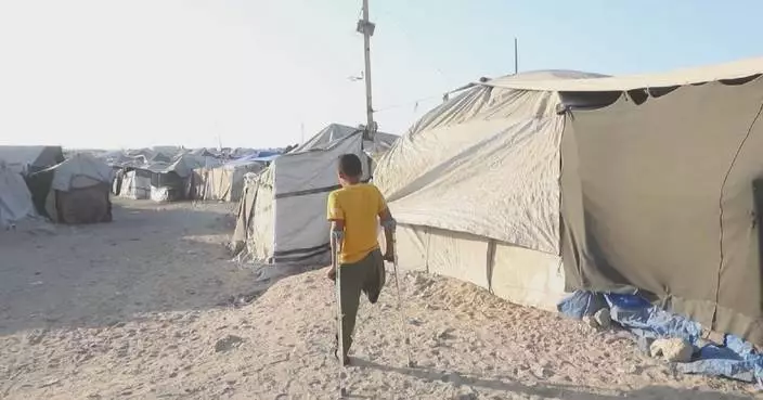 Gaza amputees struggling to secure access to recovery as Israel limits prosthetic materials