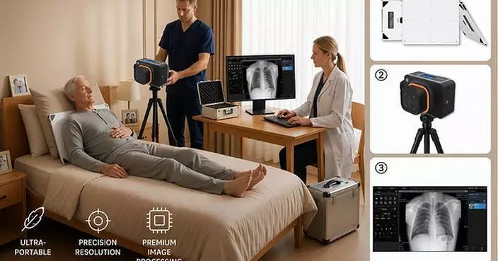 Rayence Breaks the Boundaries of Point-of-Care Imaging with the Launch of Integrated Portable X-ray Diagnostic Solutions 'Anywhere-M' and 'Anywhere-V'