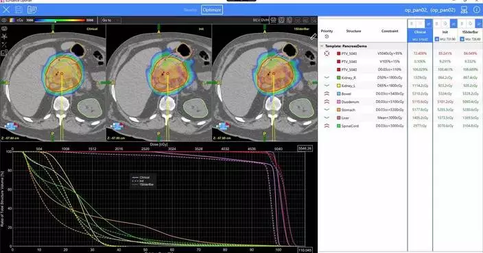 Radformation Receives USFDA 510(k) Clearance for OptiPlan Automated VMAT Planning