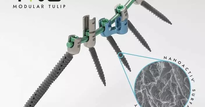 Xenix Medical Announces FDA Clearance of NanoACTIV™ Surface Technology for Its Riva® Posterior Fixation System