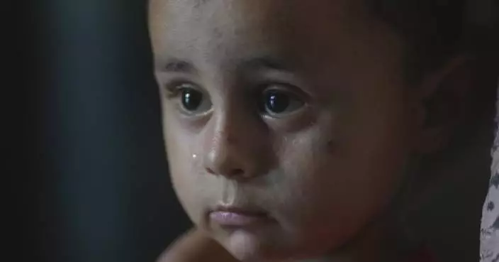 Children face skin disease crisis in Gaza tent camps