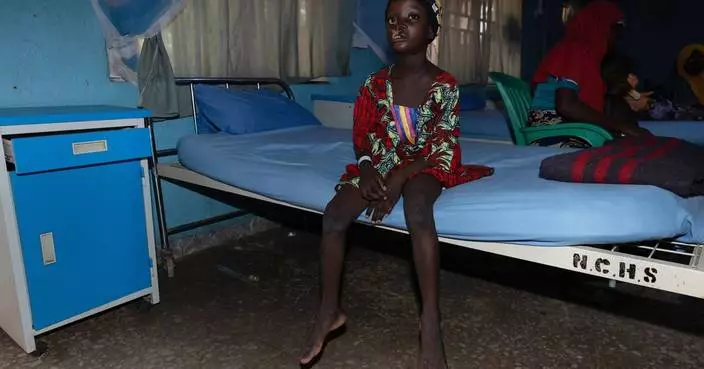 Free operations give hope to children with a neglected but deadly disease in Africa