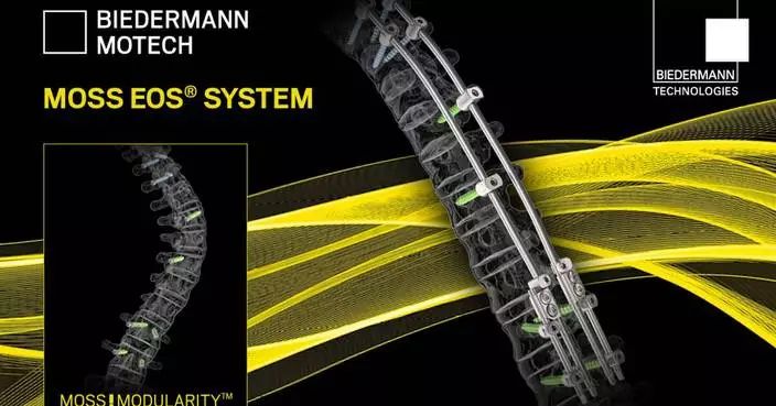 Worldwide First: Biedermann Motech Further Expands its MOSS!MODULARITY Platform with the Addition of MOSS EOS for Early Onset Scoliosis Surgery