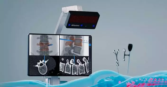 ClaroNav Kolahi Inc. Announces EU MDR Certification for Navient Surgical Navigation System