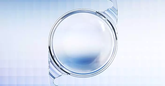 ZEISS announces availability of CT LUCIA 621P in Japan, expanding its broad ZEISS Cataract Workflow