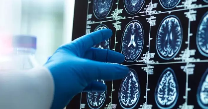 林文健：腦膜炎雙球菌感染個案或會上升 留意返港人士是否有病徵