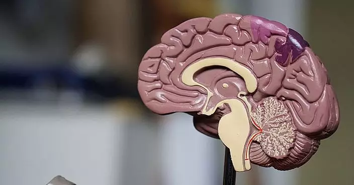台腦神經外科醫︰8類人要小心腦部病變