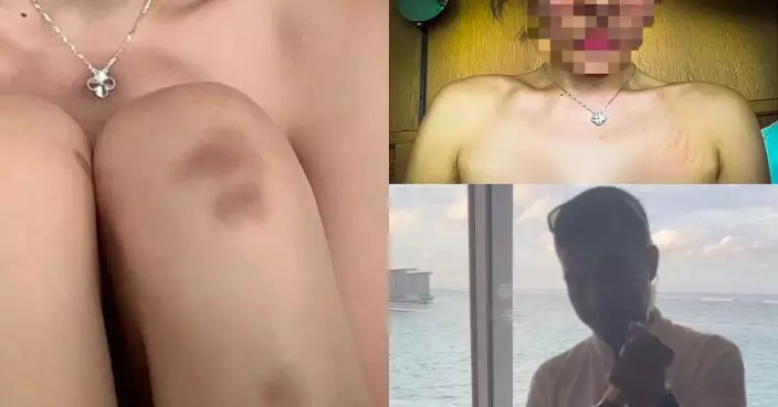女子稱被馬爾代夫酒店職員性侵 斥酒店和當地警方不作為