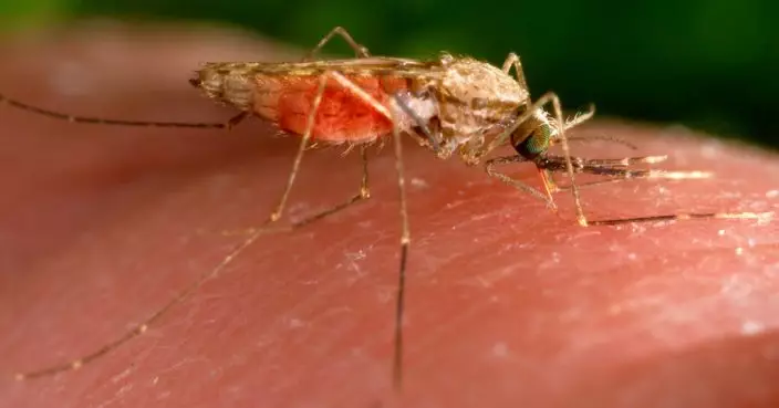 20年來首度 美國通報5宗本土瘧疾病例