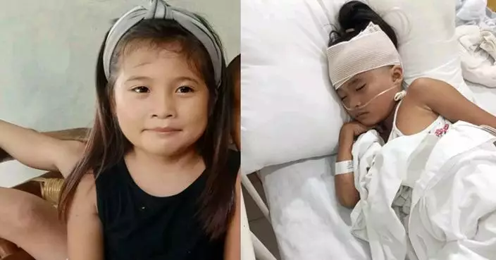 菲女童遇罕見意外頭插剪刀 獲善長捐款一周後完成手術