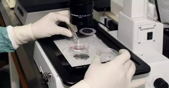 中大卵巢組織冷凍保存技術 助接受治療癌患者保留生殖能力