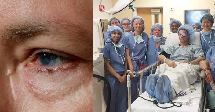 美國成功重建眼角膜幹細胞 患者受傷5年後重見光明