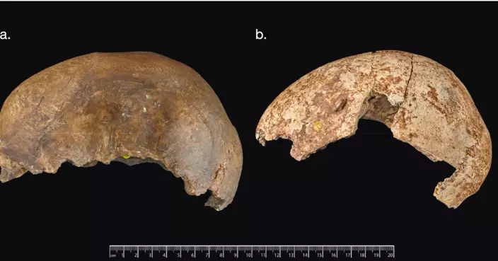 1.5萬年前骸骨驚現咬痕 專家指食人習俗並非充飢