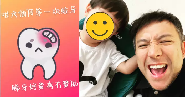 張致恒獻出人生「第一次」  飽受蛀牙困擾IG求贊助：睇牙好貴