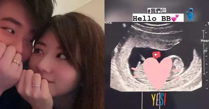 27歲陳嘉慧婚後兩個月宣布懷孕 貼超聲波相報喜：我們仨