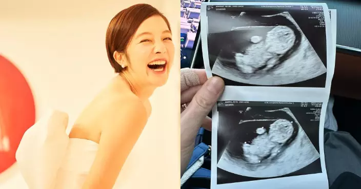 40歲黃寶羅晒超聲波照宣布懷孕 與車賢宇結婚一年成功造人