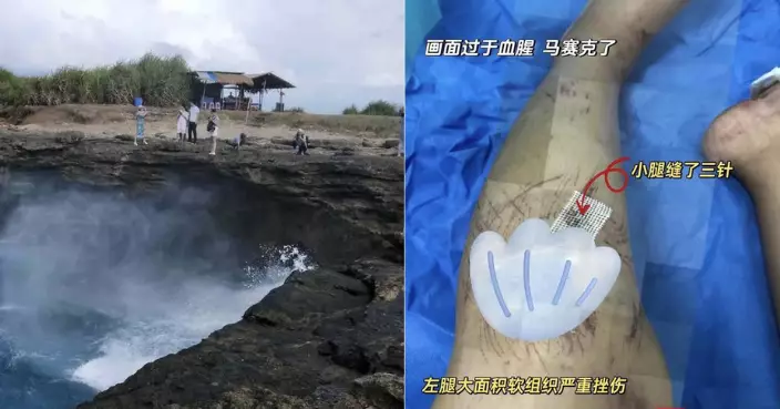 遭巨浪摔出渾身是血！內地客打卡巴厘島「惡魔的眼淚」險喪命