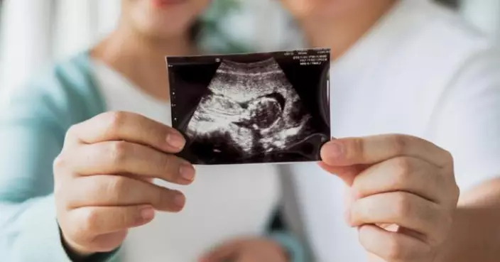 為騙福利 意大利婦24年「假孕17次」共呃98萬！