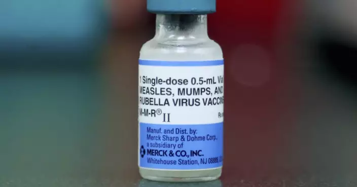 加州第3例！加州孩童返美確診麻疹或已傳300人 醫院急尋人