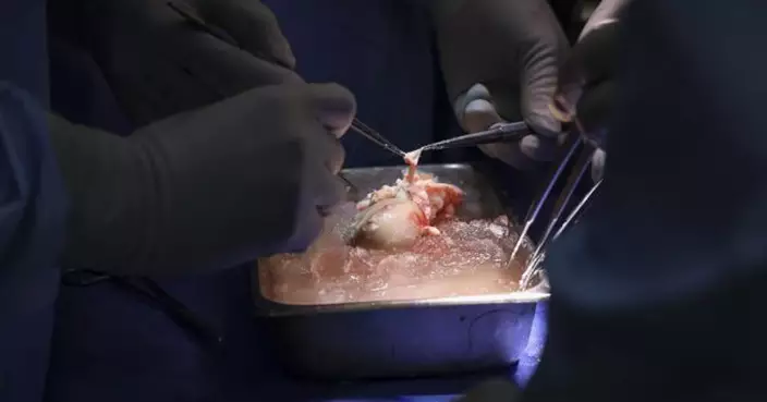 全球首例！美醫生成功將基因改造豬腎移植患者體內 帶來器官移植新希望