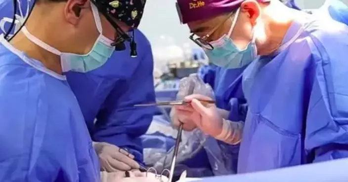 全球首例！廣州醫療團隊成功完成自主呼吸麻醉下雙肺移植手術
